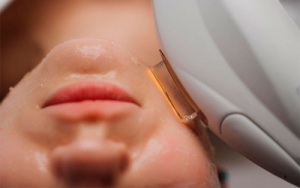 Профессиональный Смас-лифтинг в Киеве