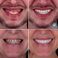 Са-Ната: услуги стоматологов в Киеве